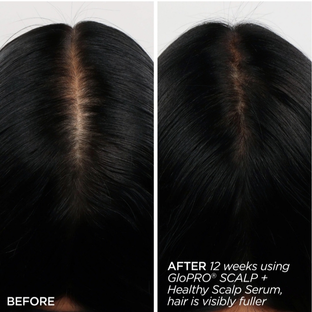 BeautyBio Scalp Therapy Set - Picture 9 of 11